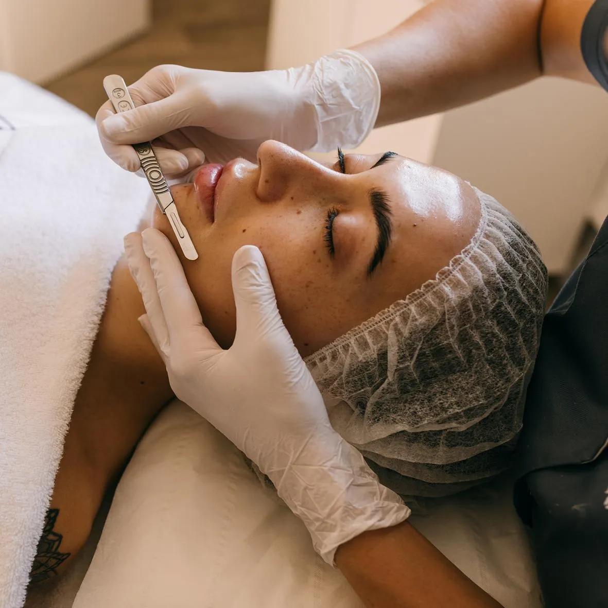 Chemical peel treatment being applied to the face at Derma Cosmedic Liverpool, with the practitioner using a brush applica...